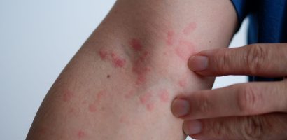 Recognizing the Signs & Symptoms of Illness or Injury